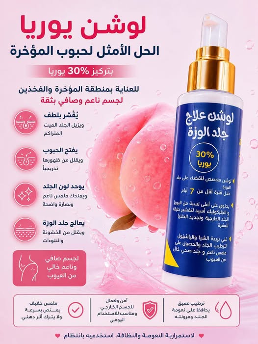 Urea Lotion for Chicken Skin and Bump Treatment 1